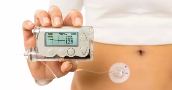 Eine Pumpe die das Leben mit Diabetes erleichtert