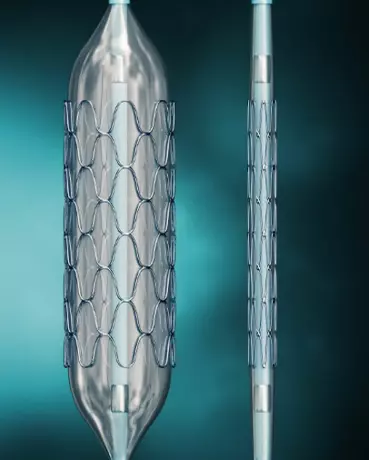 STENTS