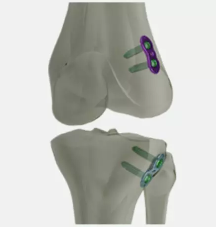 EpiFIX™ Growth-Control-Plate - Steriles Einmalkit zur Wachstumslenkung