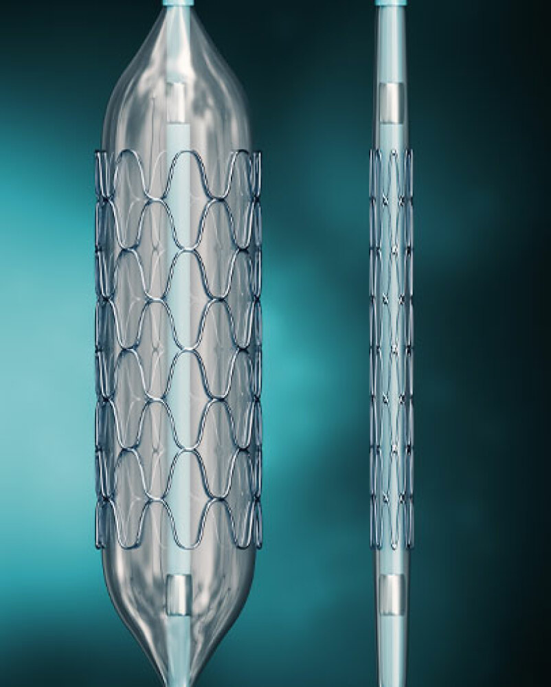 STENTS
