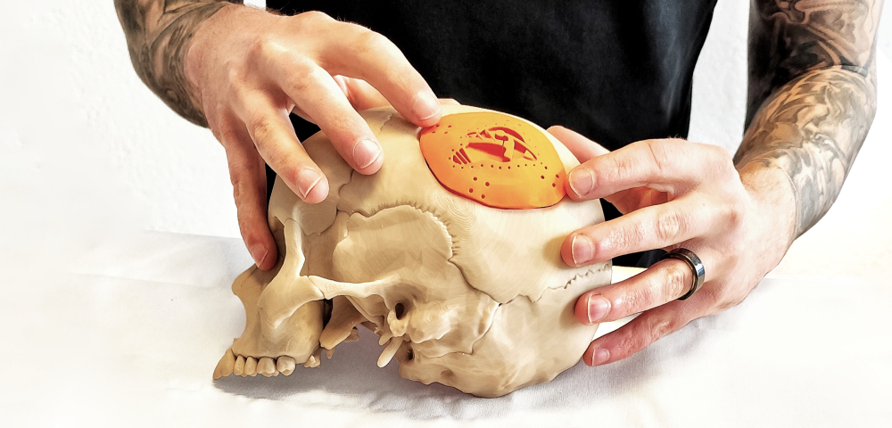 Medical Devices