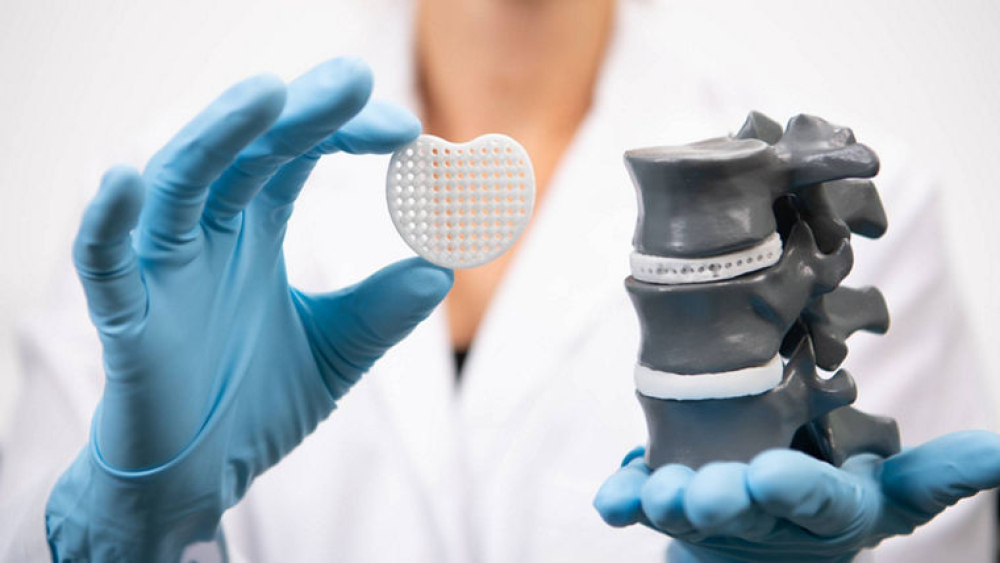 OTHER MEDICAL MATERIALS SUCH AS NITINOL AND POLYMERS